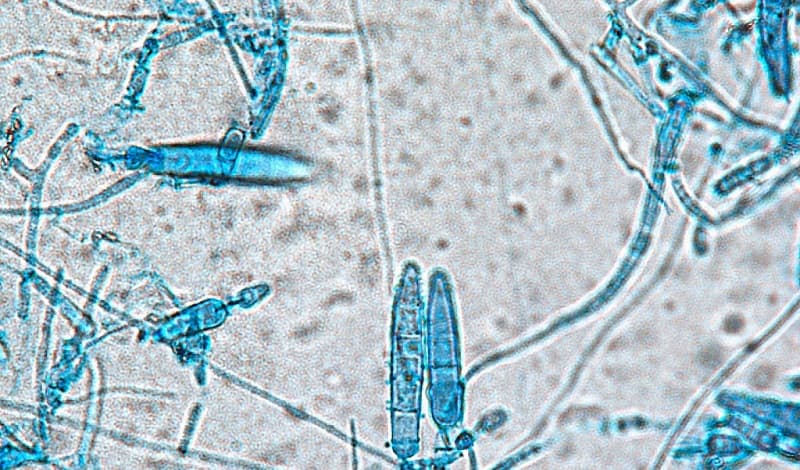 Nấm Trichophyton dưới kính hiển vi